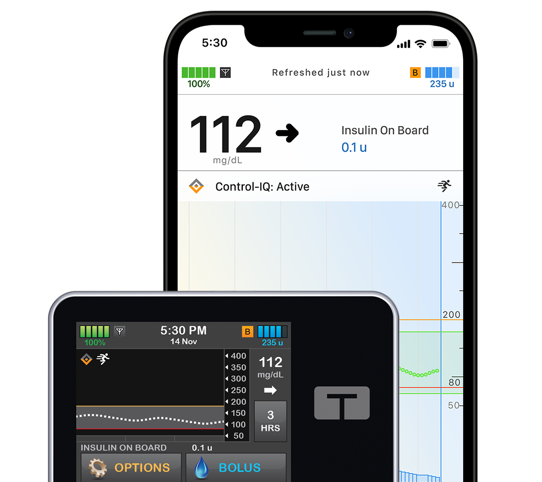 t:slim X2 insulin pump with mobile app