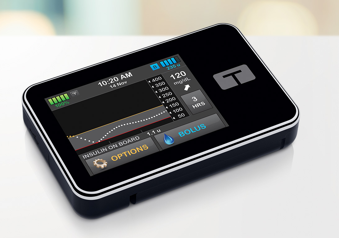 Hybrid ClosedLoop Insulin Pump Systems for Diabetes Tandem Diabetes Care