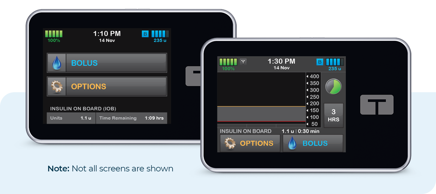 t:slim X2 insulin pump screens showing Bolus and Options settings