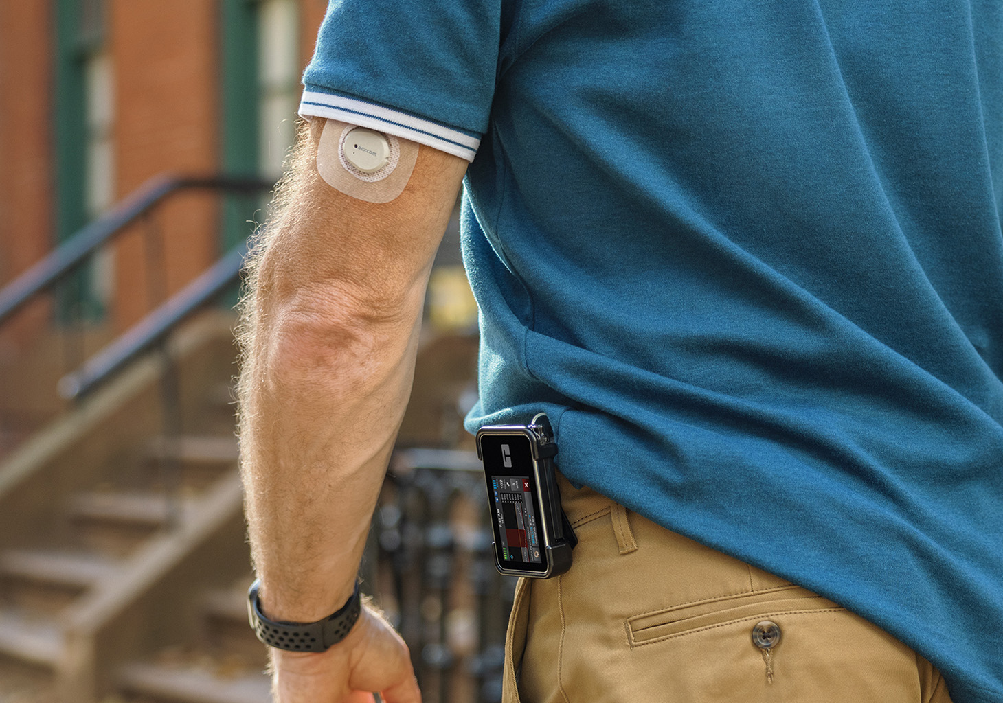 Man Walking with t:slim X2 Insulin Pump on Hip and Dexcom G7 Sensor on Arm