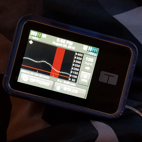 The t:slim X2 insulin pump with Basal-IQ.