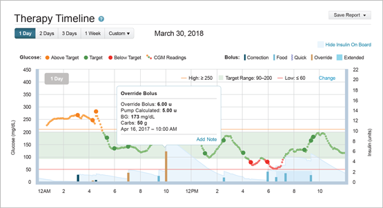 CM-000556_A_Image_tconnect_Therapy_Timeline_CGM