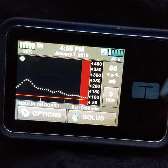 the t:slim X2 insulin pump with Basal-IQ