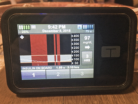 The t:slim X2 pump with basal-IQ.