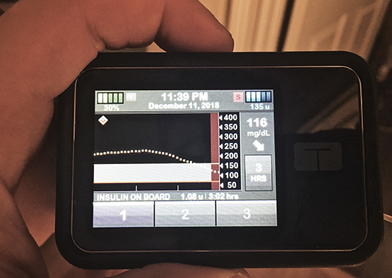 A hand holding the t:slim X2 insulin pump with Basal-IQ.