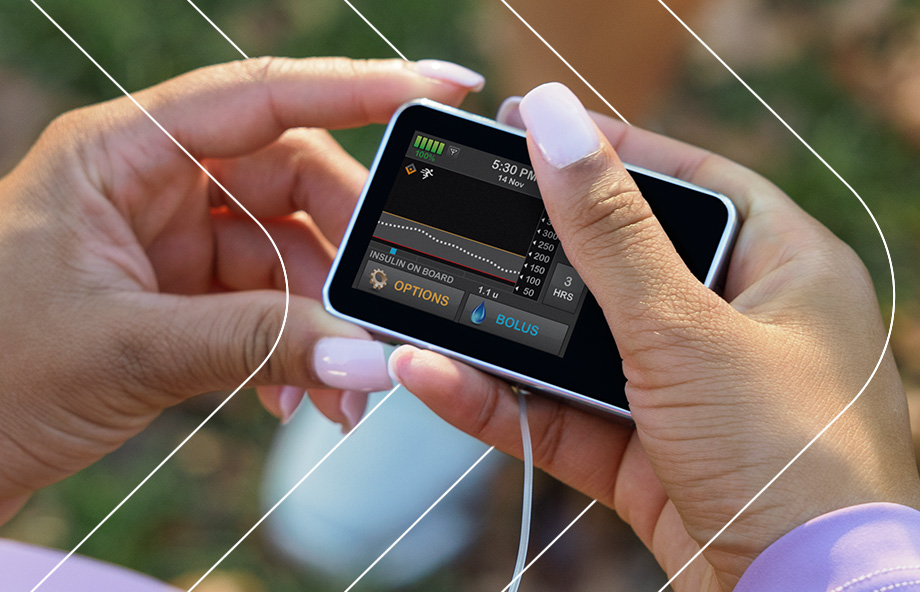 t:slim X2 insulin pump with Control-IQ technology