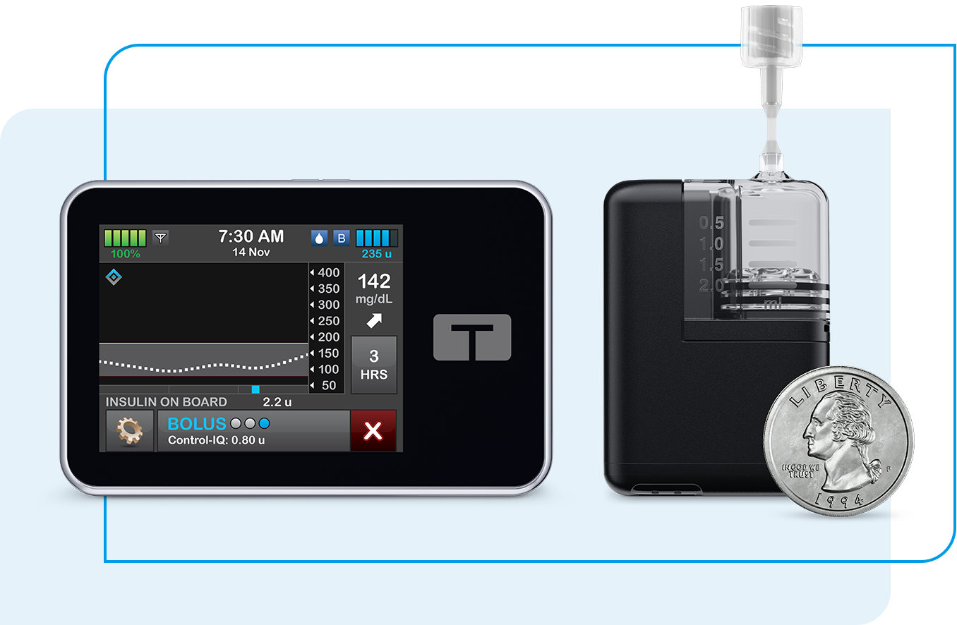 Tandem Mobi and t:slim X2 insulin pump