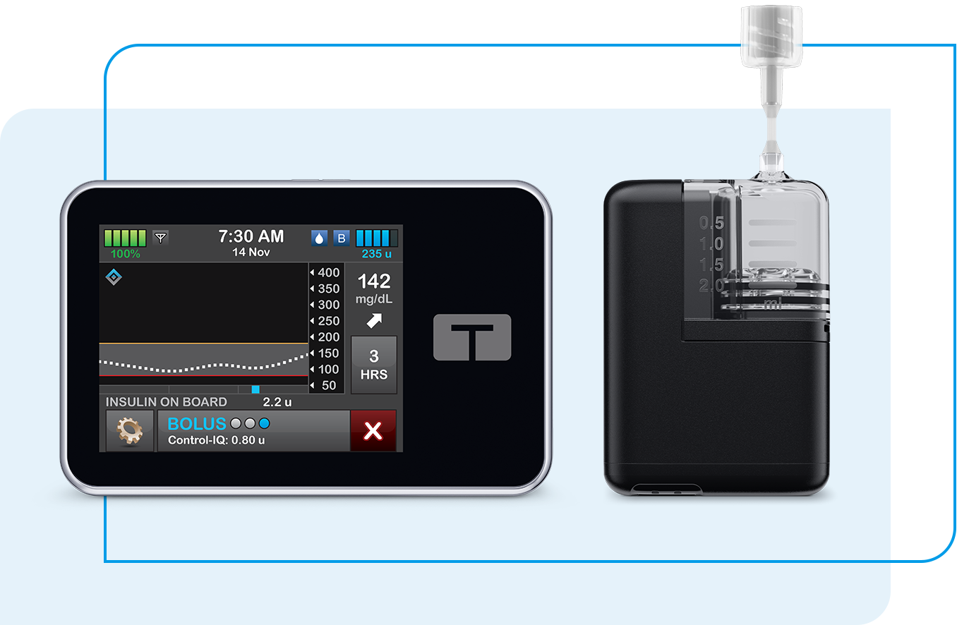Tandem Mobi and t:slim X2 insulin pump
