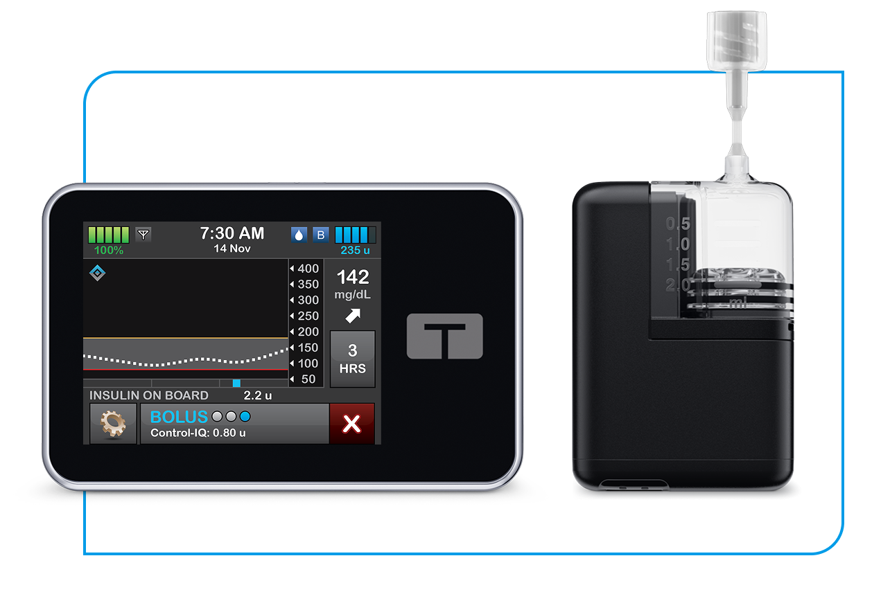 t:slim X2 insulin pump and Tandem Mobi system