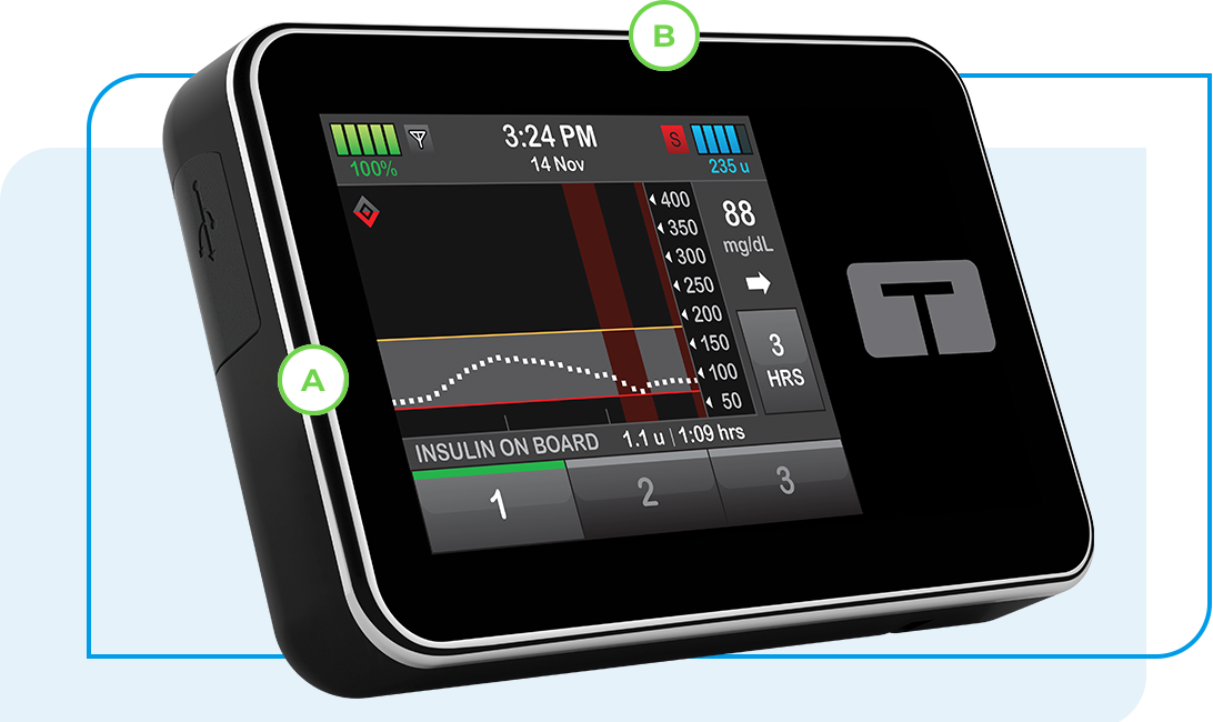 Basal-IQ Technology with Dexcom G6 CGM