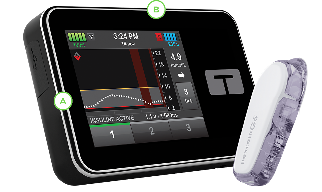 Basal-IQ Technology with Dexcom G6 CGM