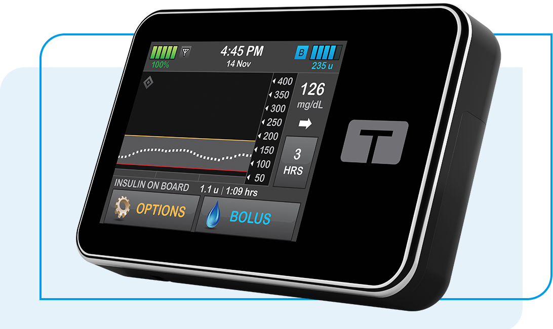 Basal-IQ Technology with Dexcom G6 CGM