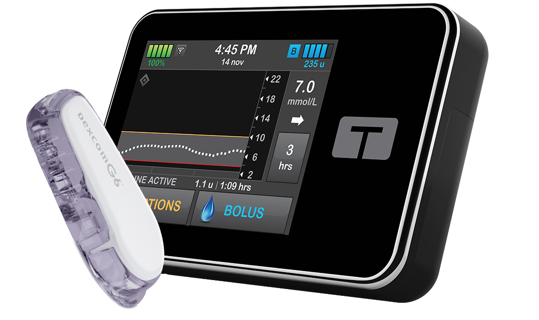 Basal-IQ Technology with Dexcom G6 CGM