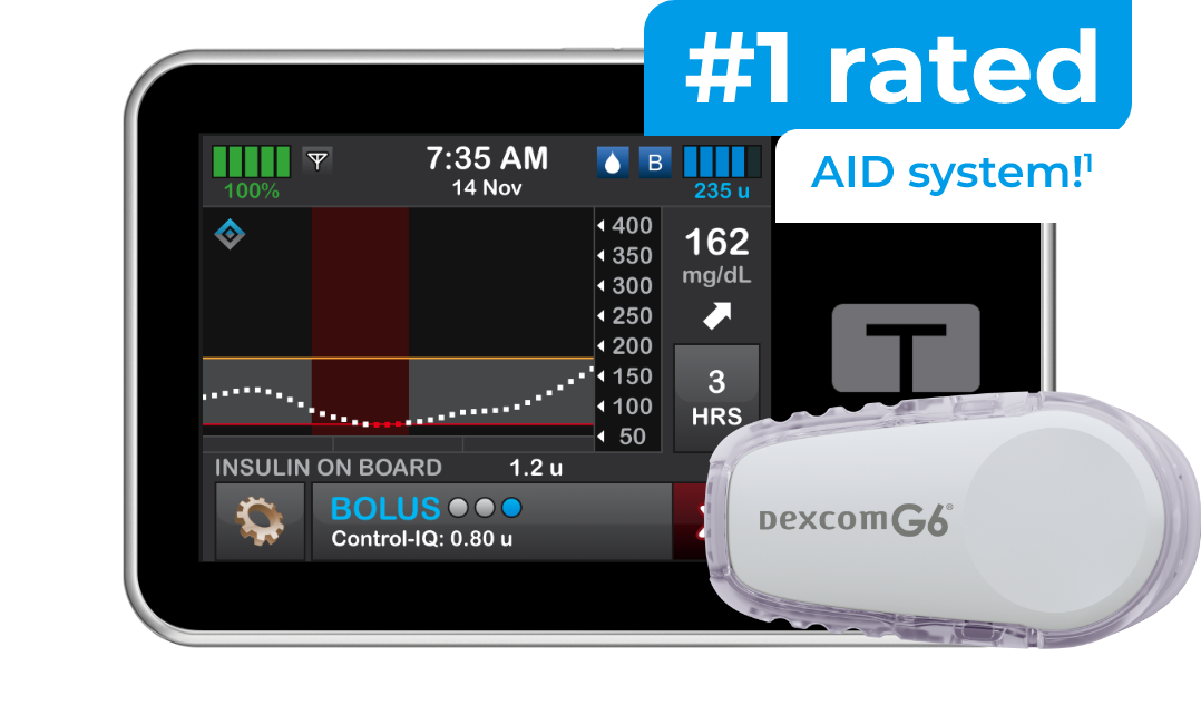 The number 1 rated AID system: the t:slim X2 insulin pump with the Dexcom G6 CGM