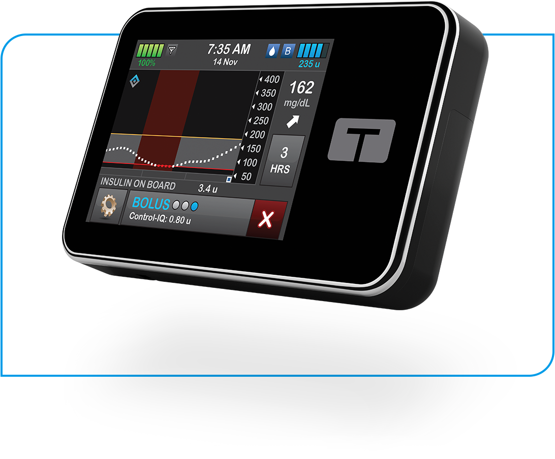 t:slim X2 Insulin Pump