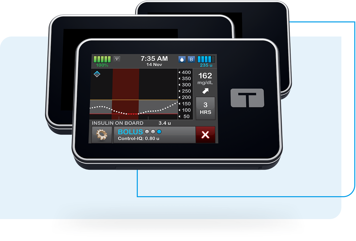 t:slim X2 insulin pump