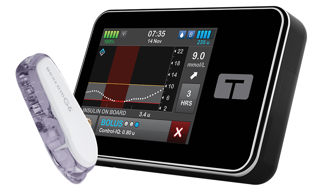 ControlIQ Software Update Tandem Diabetes Care