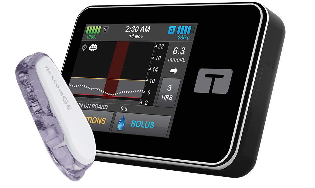 Sleep Activity with Dexcom G6 CGM