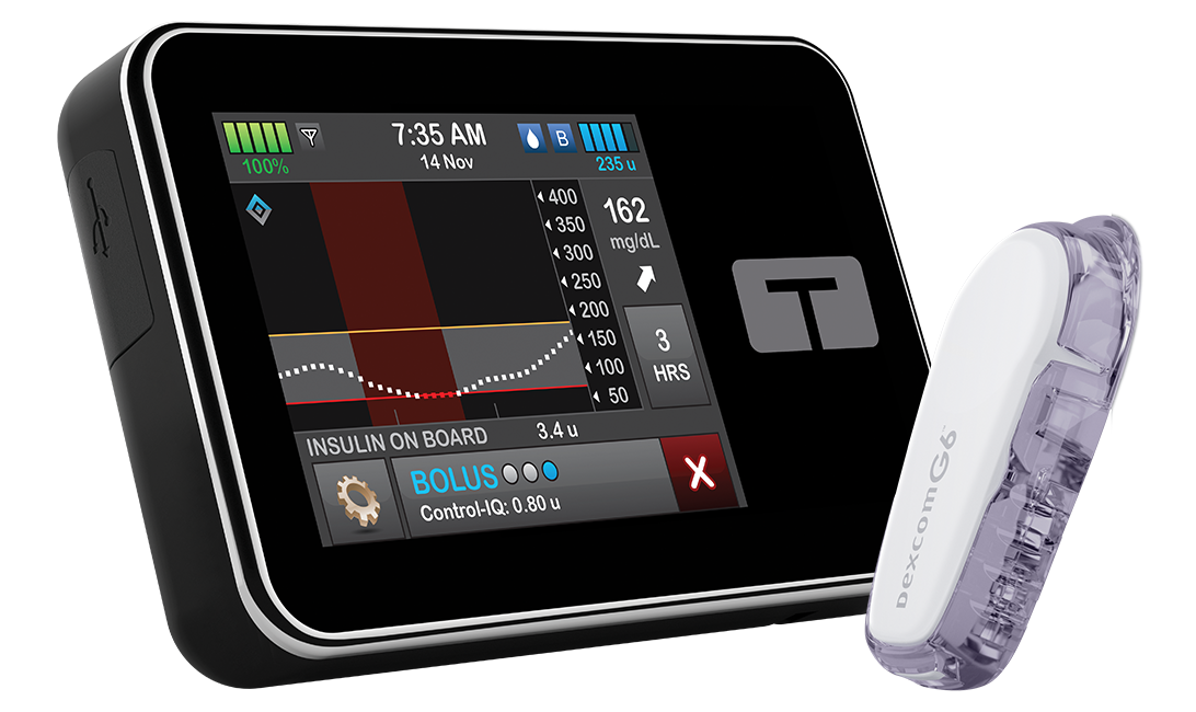 tandem diabetes travel loaner pump