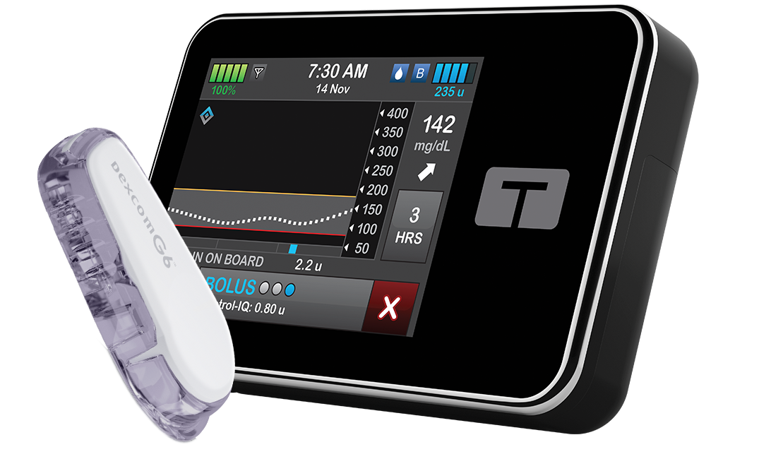 Continuous glucose monitoring (CGM) Dexcom G6 (transmitter and sensor)