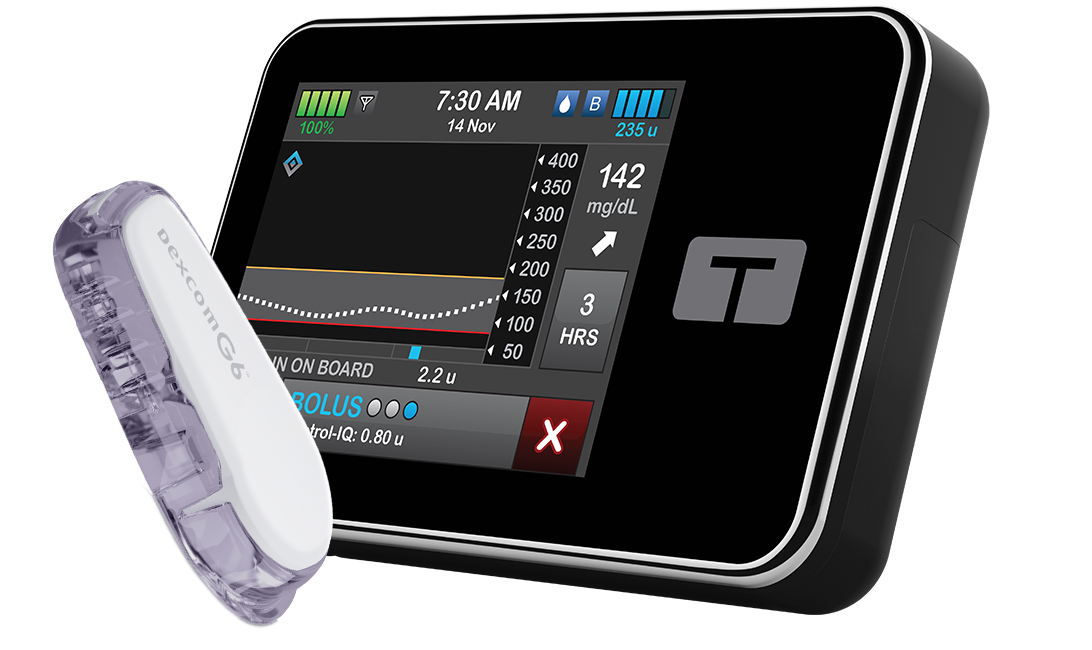 G6 CGM & tslim X2 Pump Integration Tandem Diabetes Care