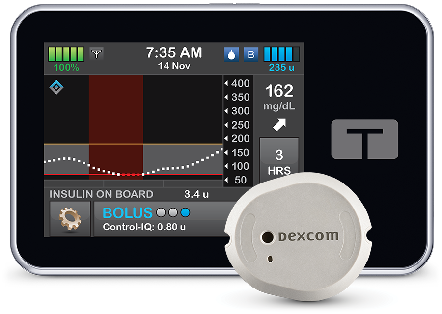 t:slim X2 Insulin Pump with Dexcom G& CGM