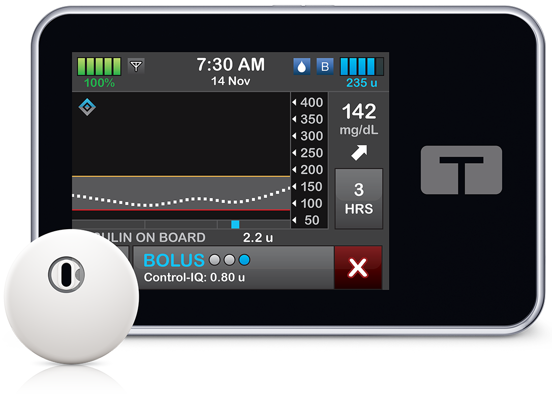 Tandem t:slim X2 insulin pump and FreeStyle Libre 3 Plus sensor