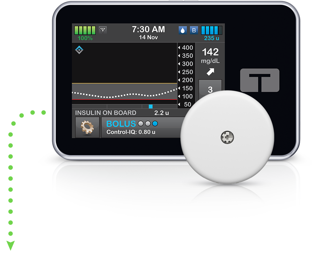 t:slim X2 insulin pump with FreeStyle Libre 2 Plus