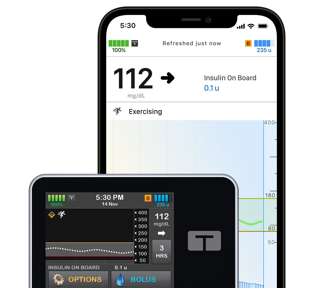 t:slim X2 insulin pump with mobile app