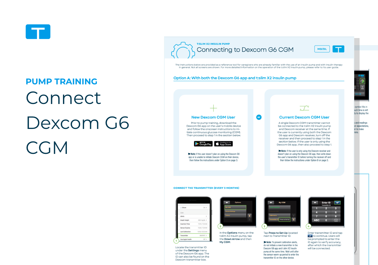 Connecting Dexcom CGM