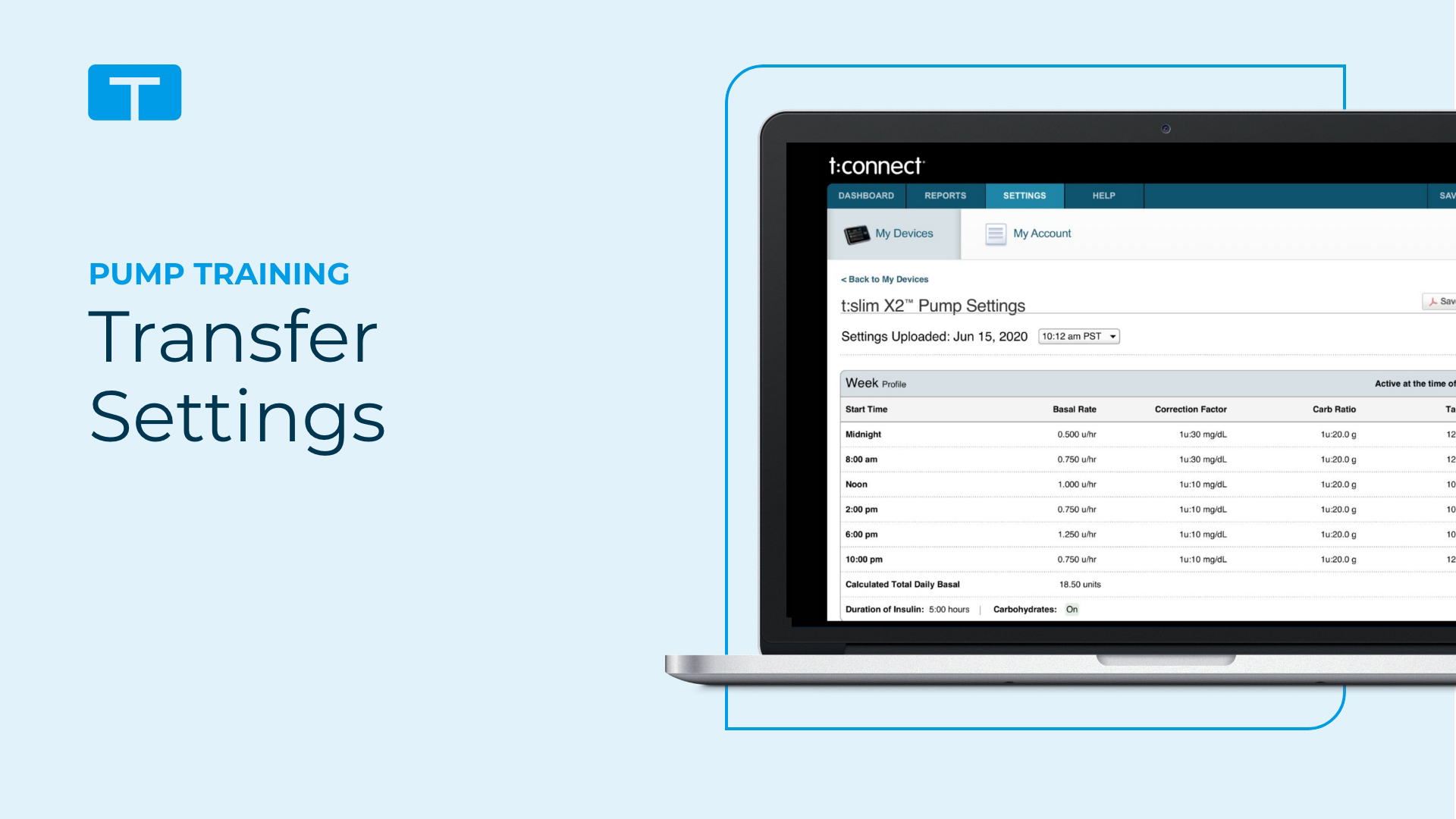 View transfer settings training module