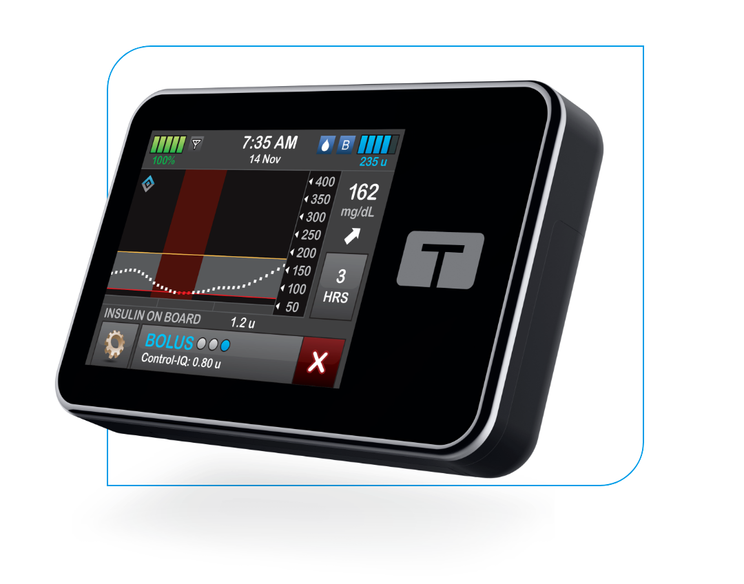 Troubleshooting Glucose