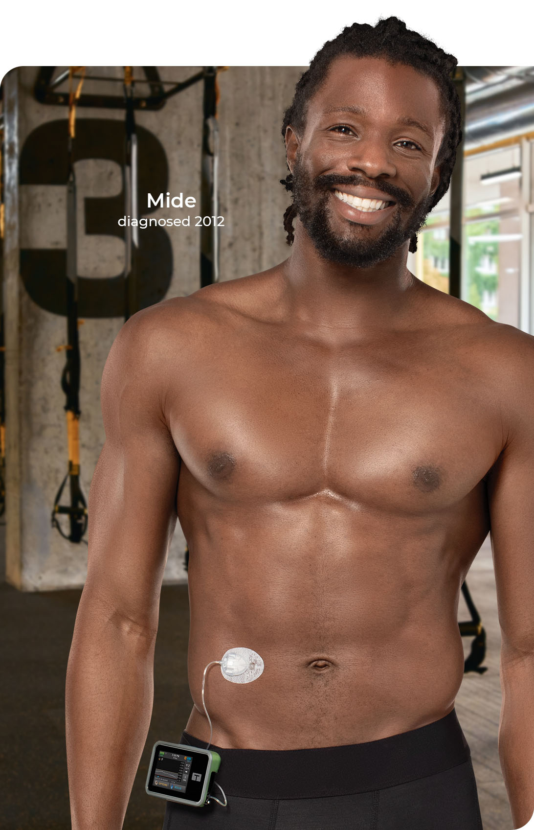 Infusion Sets for Insulin Infusion Tandem Diabetes Care